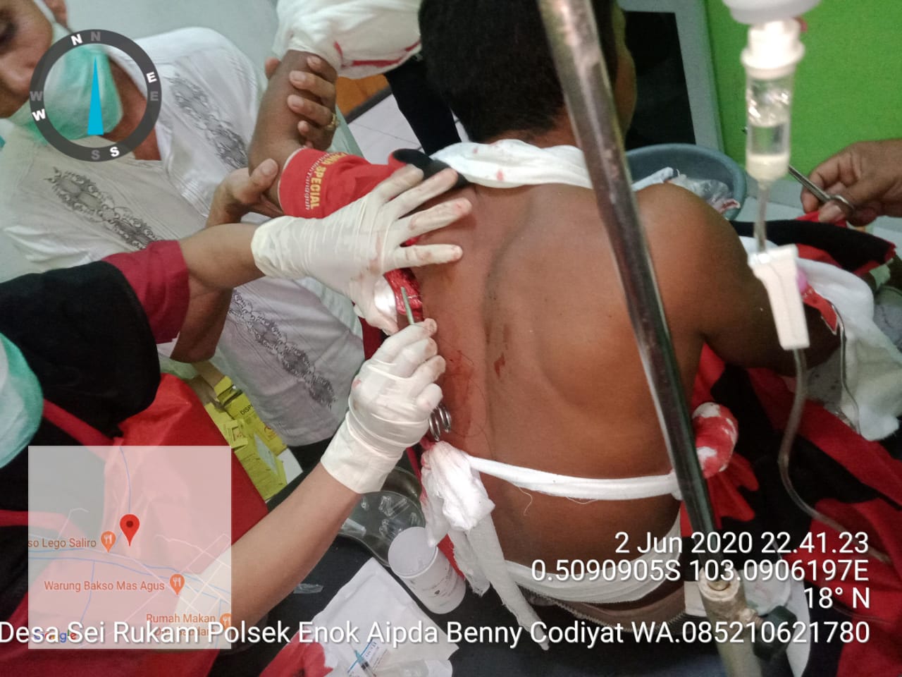 Suami Istri Adu Cek Cok Mertua Kenak Imbasnya Dibacok Menantu