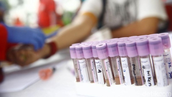Kenapa? Pasien London dan Pasien Berlin Bisa Sembuh dari Infeksi HIV
