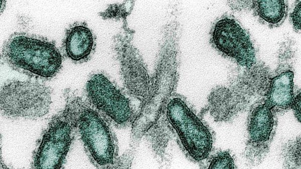 Sembilan Virus Mematikan di Dunia, Ada Berpotensi Wabah di Indonesia