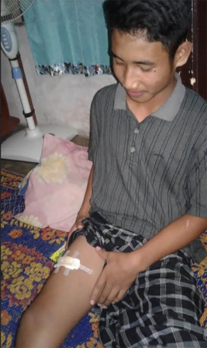 Kisah Remaja Pangean Selamat dari Serangan Buaya di Sungai Kuantan
