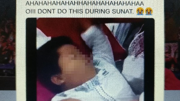 Viral Ekspresi Anak Pura-pura Pingsan Saat akan Disunat