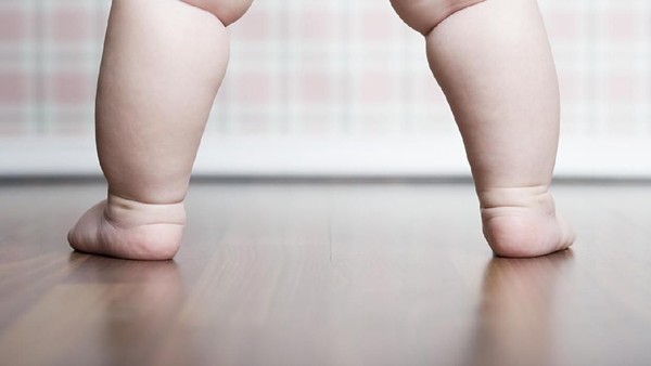 2025 Diprediksi, 70 Juta Anak di Dunia Alami Obesitas